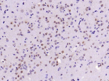 Zic2 Rabbit Polyclonal Antibody