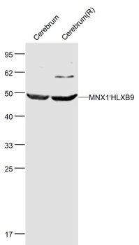 MNX1 antibody
