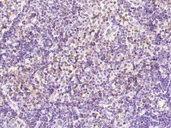 KIF18B Rabbit Polyclonal Antibody