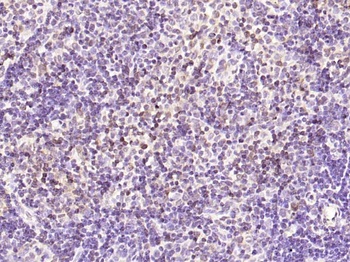 KIF18B antibody