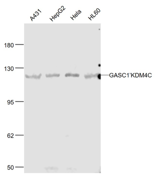 GASC1/KDM4C Rabbit Polyclonal Antibody