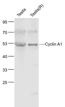 Cyclin A1 antibody