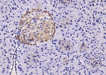 GLIPR1 antibody