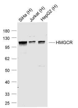 HMGCR antibody