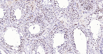 PCNA Recombinant Rabbit Monoclonal Antibody (Nuclear Loading Control)