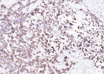 Galectin 8 antibody