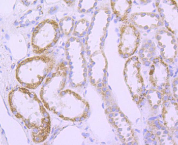 SOD2 Recombinant Rabbit Monoclonal Antibody