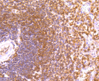 ETS1 Recombinant Rabbit Monoclonal Antibody