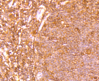 ETS1 Recombinant Rabbit Monoclonal Antibody