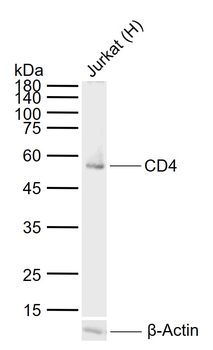 CD4 Recombinant Rabbit Monoclonal Antibody