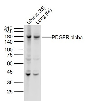 PDGFR Alpha antibody