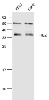 HBZ antibody