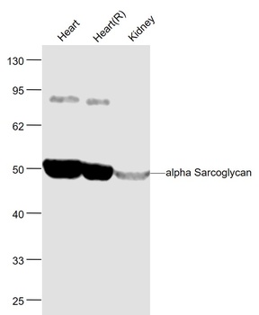 Alpha Sarcoglycan antibody
