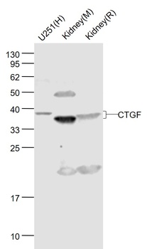 CTGF antibody