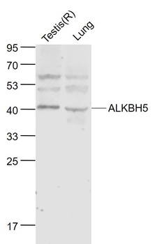 ALKBH5 antibody