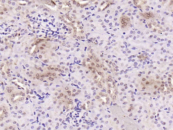 TBX3 Rabbit Polyclonal Antibody