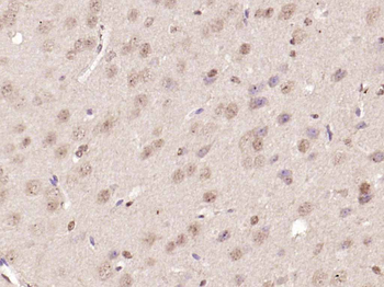Nur77 Rabbit Polyclonal Antibody