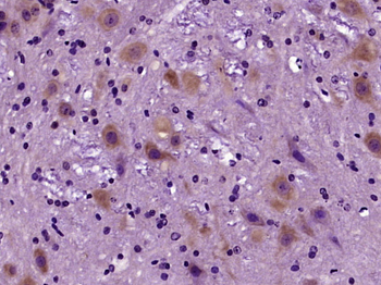 NDUFS3 Rabbit Polyclonal Antibody