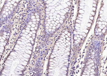 Phospho-HDAC4 (Ser246) + HDAC5 (Ser259) + HDAC7 (Ser155) Rabbit Polyclonal Antibody