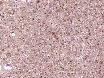 HDAC7 Rabbit Polyclonal Antibody