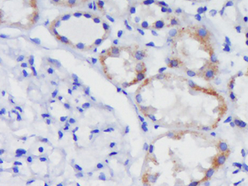 HDAC10 Rabbit Polyclonal Antibody
