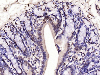 Histone H3 (Di Methyl K9) Rabbit Polyclonal Antibody