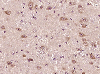 IL22BP Rabbit Polyclonal Antibody