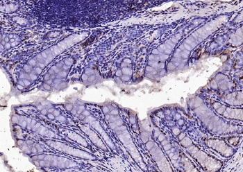 IL33 Rabbit Polyclonal Antibody