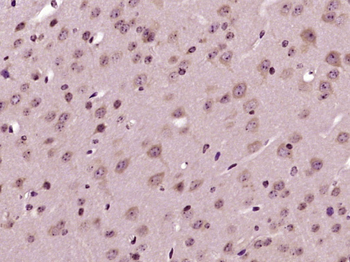 Phospho-ILK-1 (Ser246) Rabbit Polyclonal Antibody