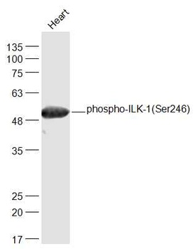 ILK1 (phospho-Ser246) antibody