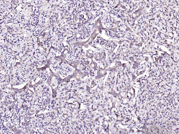 Phospho-IRF3 (Ser396) Rabbit Polyclonal Antibody