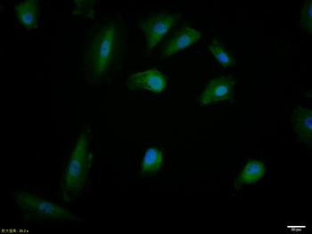 Phospho-IRS1 (Ser789) Rabbit Polyclonal Antibody