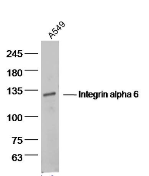 Integrin alpha 6 Rabbit Polyclonal Antibody