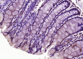 Phospho-MAPK8 (Thr183 + Tyr185) Rabbit Polyclonal Antibody