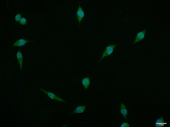 Phospho-KLF5 (Ser311) Rabbit Polyclonal Antibody