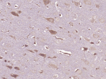 Mu Opioid receptor Rabbit Polyclonal Antibody