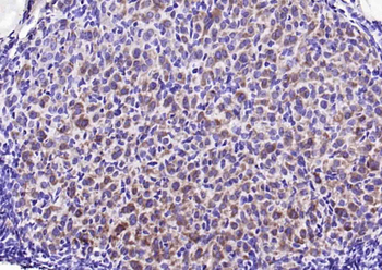 Phospho-STMN1 (Ser16) Rabbit Polyclonal Antibody