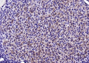 Stathmin (phospho-Ser25) antibody