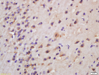 Ceramide synthase 1 Rabbit Polyclonal Antibody