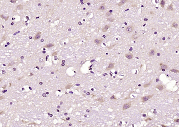 Phospho-LATS1 (Ser909) Rabbit Polyclonal Antibody