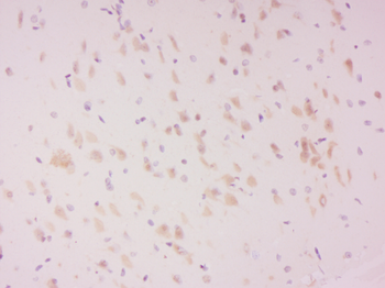 Phospho-LATS2 (Ser83) Rabbit Polyclonal Antibody
