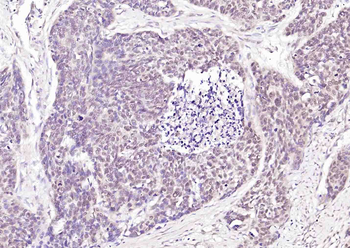 LKB1 Rabbit Polyclonal Antibody