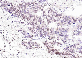 Phospho-LKB1 (Ser334) Rabbit Polyclonal Antibody