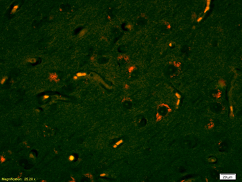 Lyn Rabbit Polyclonal Antibody