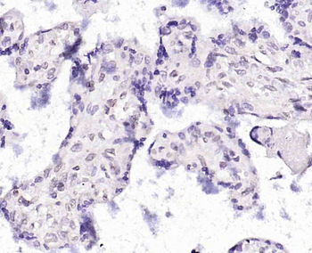 MAGEA4 Rabbit Polyclonal Antibody