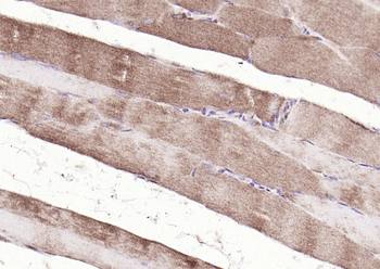 MAPKAP Kinase 2 Rabbit Polyclonal Antibody