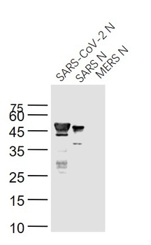 SARS N (nucleocapsid) antibody