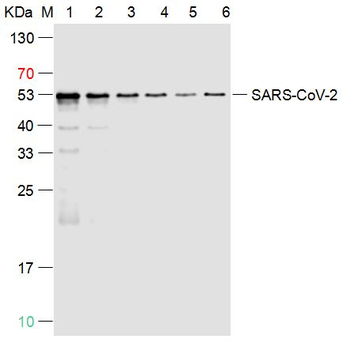 SARS-CoV-2 (2019-nCoV) Nucleocapsid Mouse Monoclonal Antibody