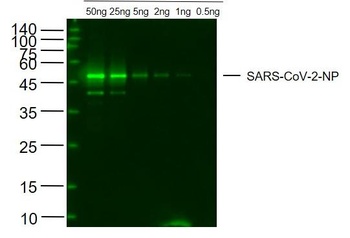 SARS-CoV-2 N protein antibody