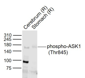 Phospho-ASK1 (Thr845) Rabbit Polyclonal Antibody
